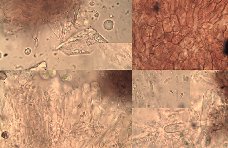 Unguiculariopsis allantospora micro
